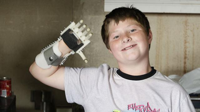 Science Is Turning Disabled Kids Into Awesome Cyborgs
