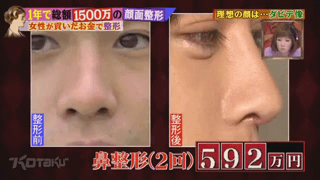 Japanese Man Spends $US150,000 To Look Like Michelangelo’s David