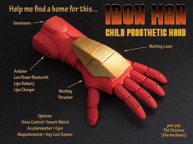 Artificial Iron Man Hand Makes Kids Feel Like Tony Stark