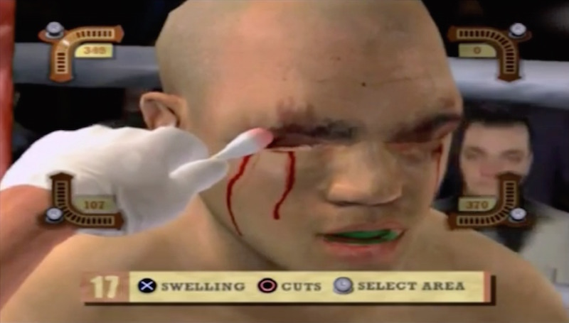 A Pro Fighter’s Best Friend Is The Guy Who Stops The Bleeding