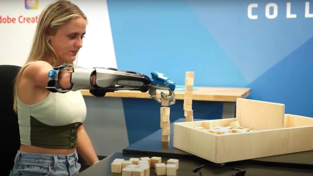 Halo Devs Team Up To Make Master Chief Prosthetics For Kids With Limb Loss